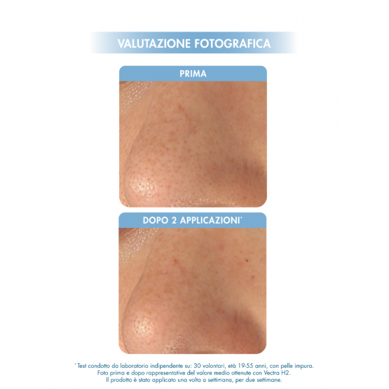 Miamo - Blackhead Duo Nose Mask